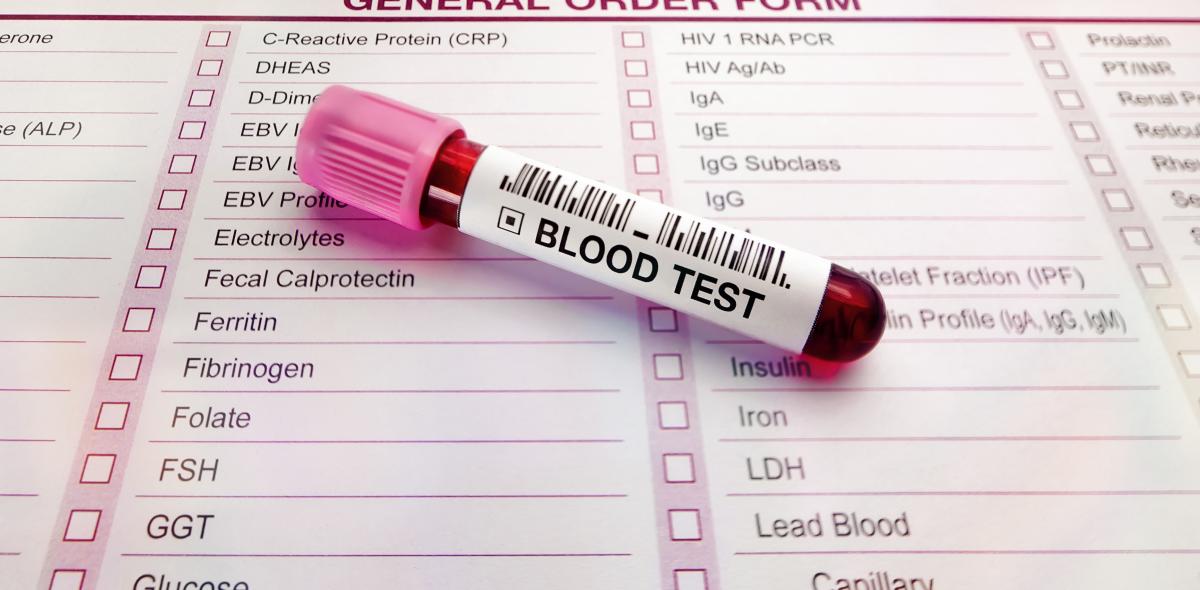 Test tube on a blood test order form.
